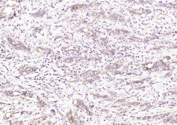 SLC30A2 Polyclonal Antibody