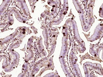 RAD51AP2 Polyclonal Antibody