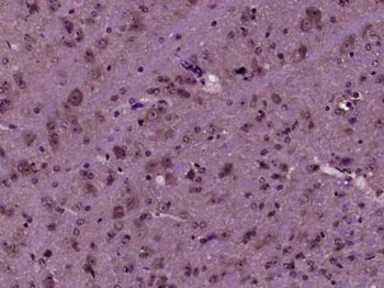 RABGGTA Polyclonal Antibody
