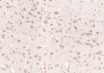 PAM/Peptidylglycine 2 hydroxylase Polyclonal Antibody