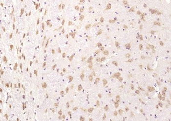 PAM/Peptidylglycine 2 hydroxylase Polyclonal Antibody
