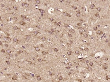 C16orf5 Polyclonal Antibody