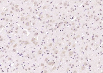 Importin 8 Polyclonal Antibody