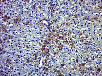 PARP14 Polyclonal Antibody