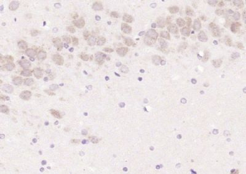LCAT Polyclonal Antibody