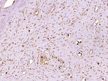 NSUN5P1 Polyclonal Antibody