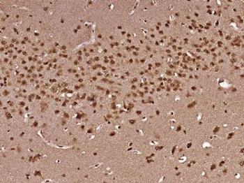 PSMA8 Polyclonal Antibody