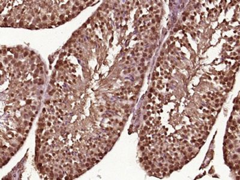 PSMA8 Polyclonal Antibody