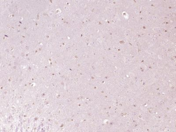 NCKIPSD Polyclonal Antibody