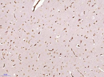 MONDOA Polyclonal Antibody