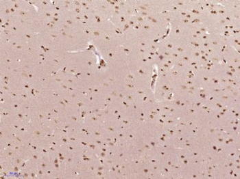 MONDOA Polyclonal Antibody