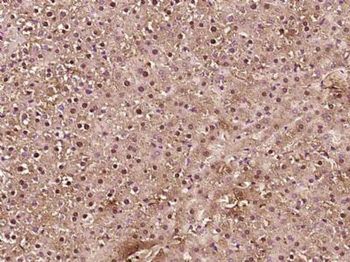 MESP2 Polyclonal Antibody
