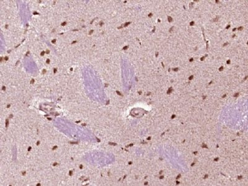 MED29 Polyclonal Antibody