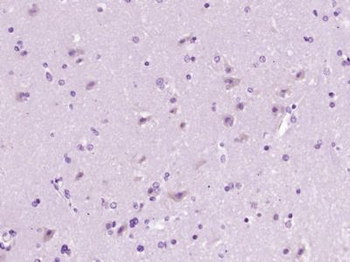 Profilin 2 Polyclonal Antibody