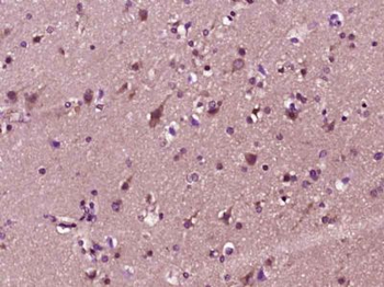 MACF1/ACF7 Polyclonal Antibody