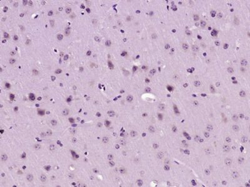 PGAM5 Polyclonal Antibody