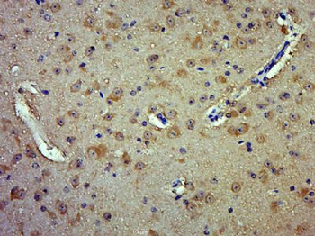 hUPF2/RENT2 Polyclonal Antibody