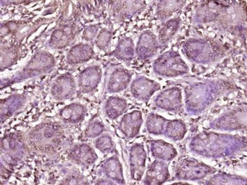 ORC6 Polyclonal Antibody