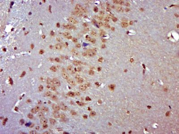 MSANTD2/C11orf61 Polyclonal Antibody