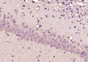 MPND Polyclonal Antibody