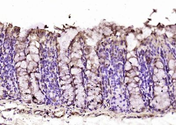 MPND Polyclonal Antibody
