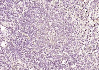 MPND Polyclonal Antibody