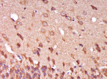 SPG11 Polyclonal Antibody