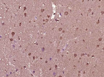 SPG11 Polyclonal Antibody