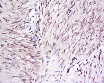 OTUD5/DUBA Polyclonal Antibody