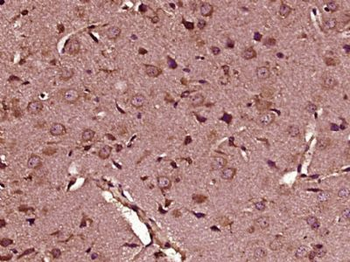 HOGA1 Polyclonal Antibody