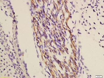 TRIOBP Polyclonal Antibody