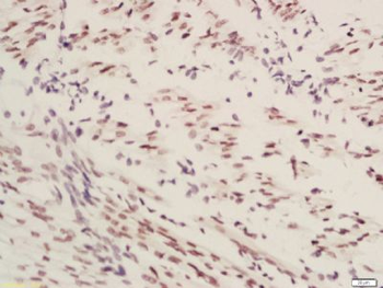 TRIOBP Polyclonal Antibody