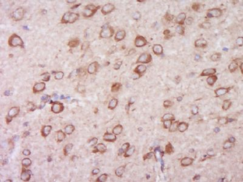 TRIP11/TRIP230 Polyclonal Antibody
