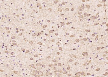 PCDA6 Polyclonal Antibody