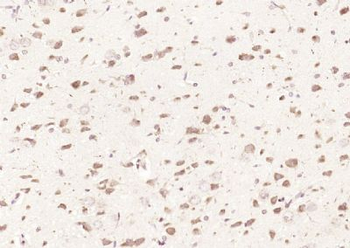 Karyopherin beta 3 Polyclonal Antibody