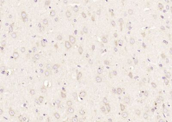 KIF2A Polyclonal Antibody