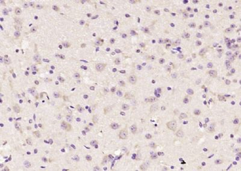 KIF2A Polyclonal Antibody