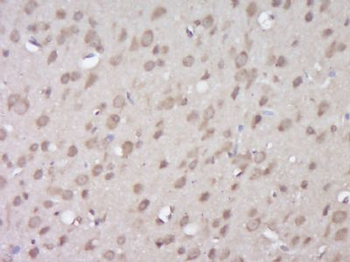 KDM3A/JMJD1A Polyclonal Antibody