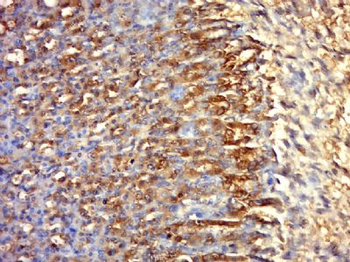 KCNH6 Polyclonal Antibody