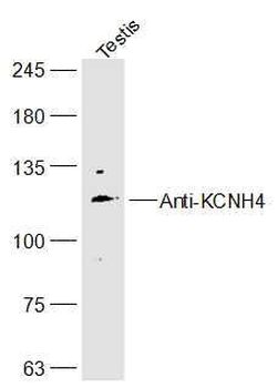 KCNH4 Polyclonal Antibody