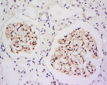 IRF2BP2 Polyclonal Antibody