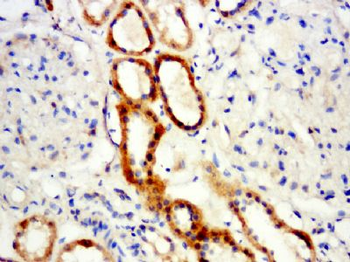 Hemoglobin subunit delta Polyclonal Antibody