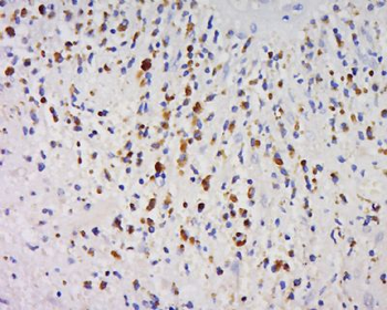 GPIHBP1 Polyclonal Antibody
