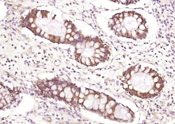 FMNL3 Polyclonal Antibody