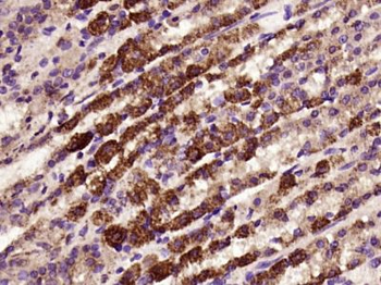 FAM83H Polyclonal Antibody