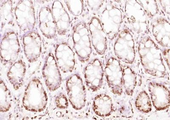 RGS14 Polyclonal Antibody