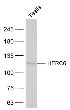 HERC6 Polyclonal Antibody