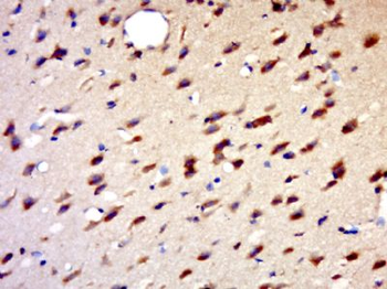 HENMT1 Polyclonal Antibody