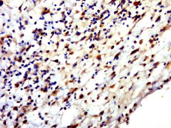 HENMT1 Polyclonal Antibody