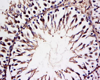 HECT E3 ubiquitin ligase Polyclonal Antibody